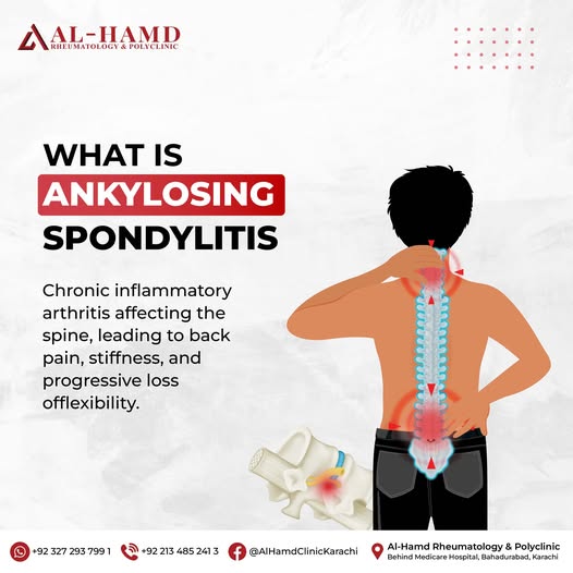 Ankylosing Spondylitis: Causes, Symptoms & Long-Term Management