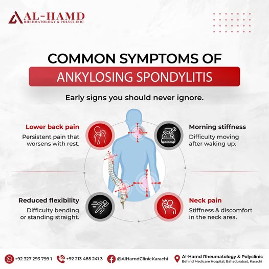 Ankylosing Spondylitis: Causes, Symptoms & Long-Term Management — infographic 2