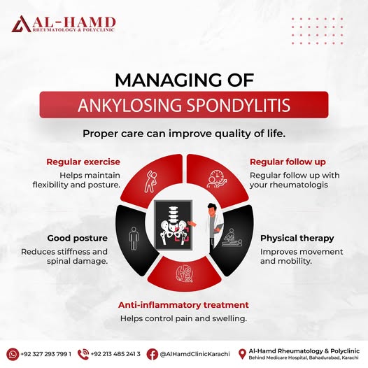 Ankylosing Spondylitis: Causes, Symptoms & Long-Term Management — infographic 4