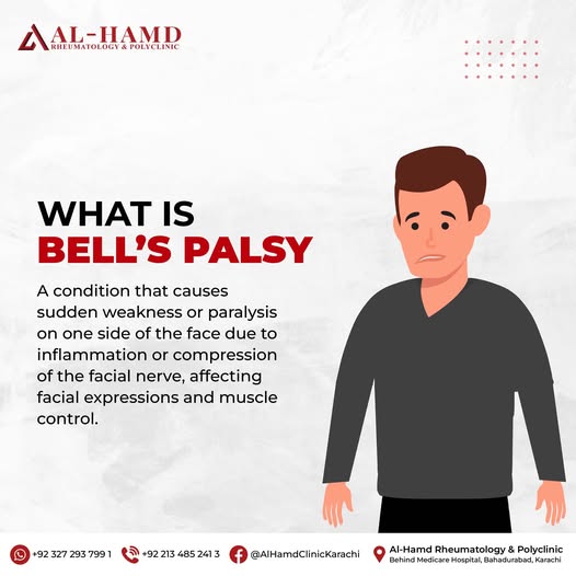 Bell's Palsy: Recognising Sudden Facial Weakness and How to Recover