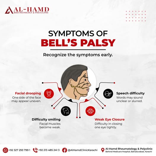 Bell's Palsy: Recognising Sudden Facial Weakness and How to Recover — infographic 2