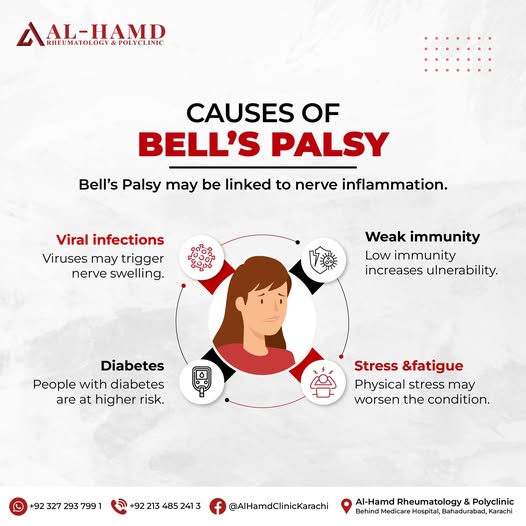 Bell's Palsy: Recognising Sudden Facial Weakness and How to Recover — infographic 3